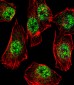RHOXF2B Antibody (Center)